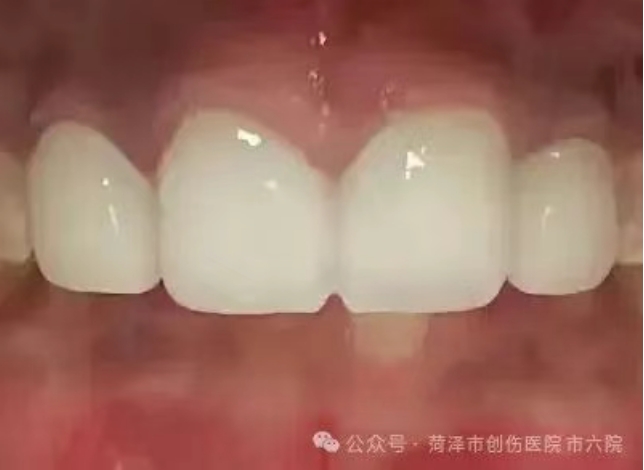 菏泽六院