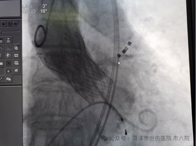 微信截图_20250906091541.png