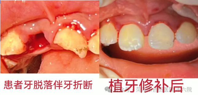 菏泽六院