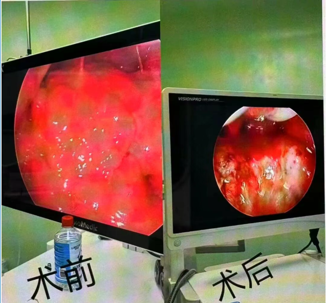 菏泽六院